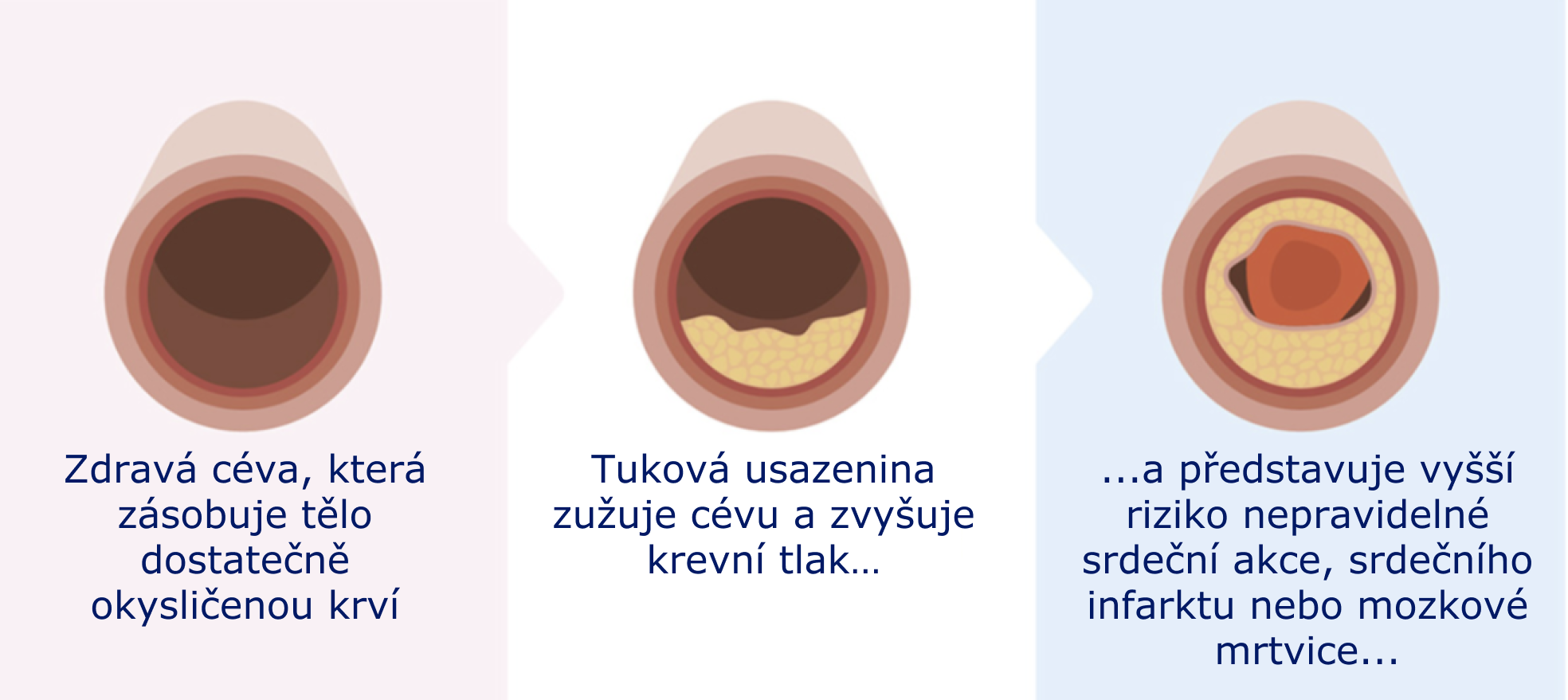 Glucose levels comparison 