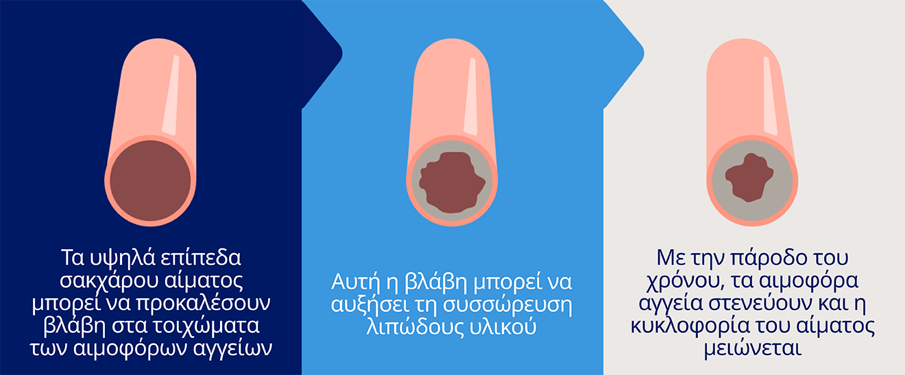 ΣΑΚΧΑΡΩΔΗΣ ΔΙΑΒΗΤΗΣ, ΕΓΚΕΦΑΛΙΚΟ ΕΠΕΙΣΟΔΙΟ ΚΑΙ ΚΑΡΔΙΑΓΓΕΙΑΚΕΣ ΠΑΘΗΣΕΙΣ
