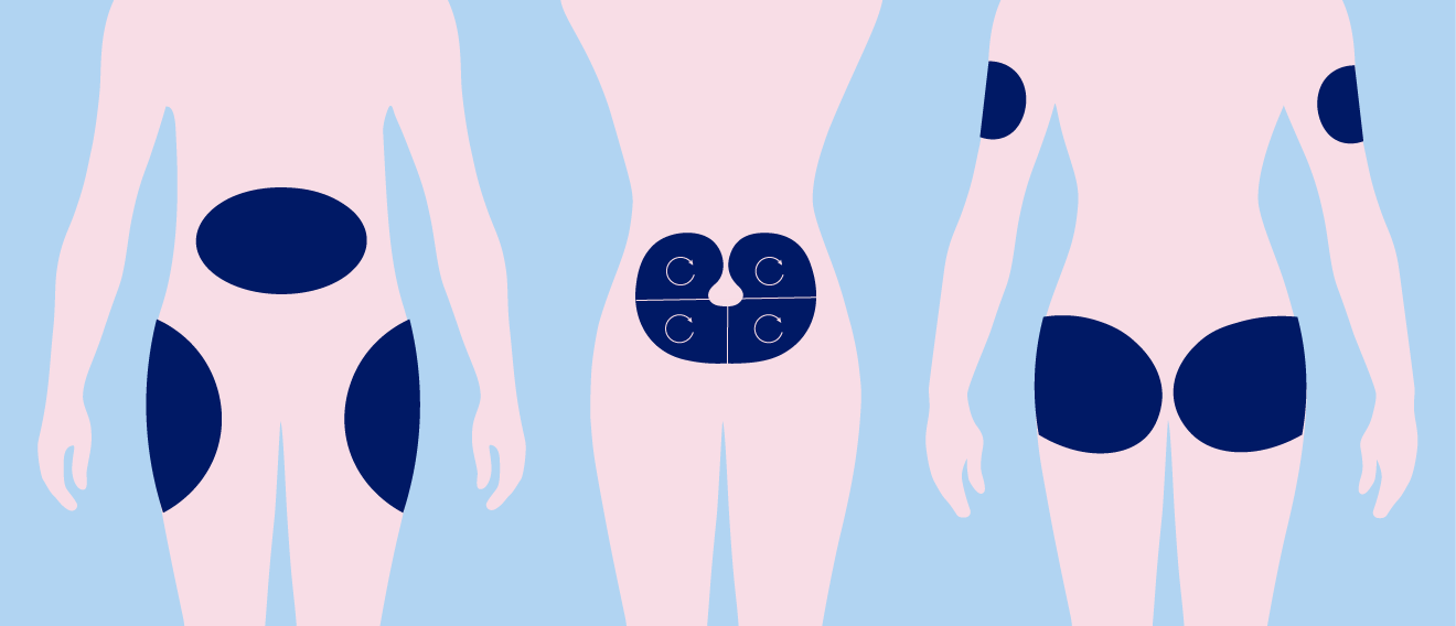 insulin injection sites